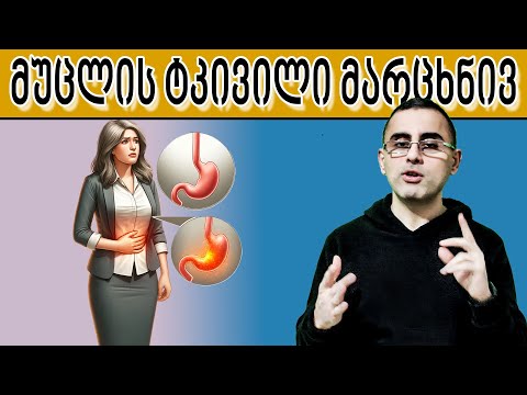 მარცხენა მხარეს მუცლის ტკივილი; ტოპ 9 მიზეზი