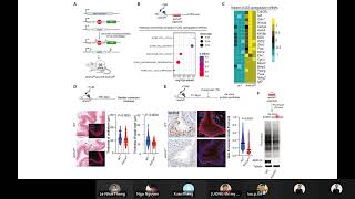 JCS 23. Transcriptional-Translational conflict in bladder cancer