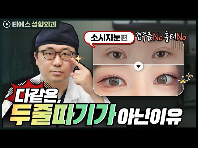 [👁 케이스리뷰 EP.2]'티에스'만의 특별한 두줄따기❗ (feat.지방 재배치를 같이 해야 하는 이유)  #눈재수술 #케이스리뷰 #극한눈