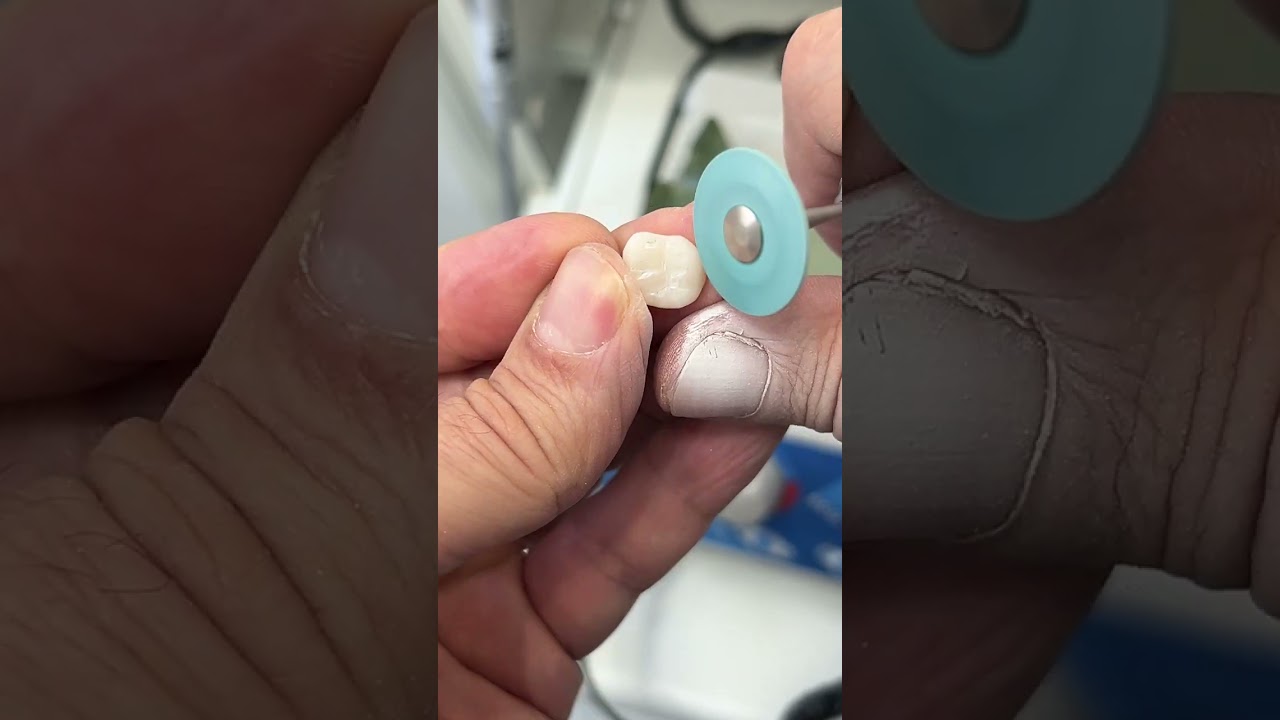 Preparo dd Coroa Cerâmica para forno.