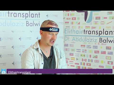 Haartransplantation Istanbul 4500 Grafts Elithairtransplant Youtube