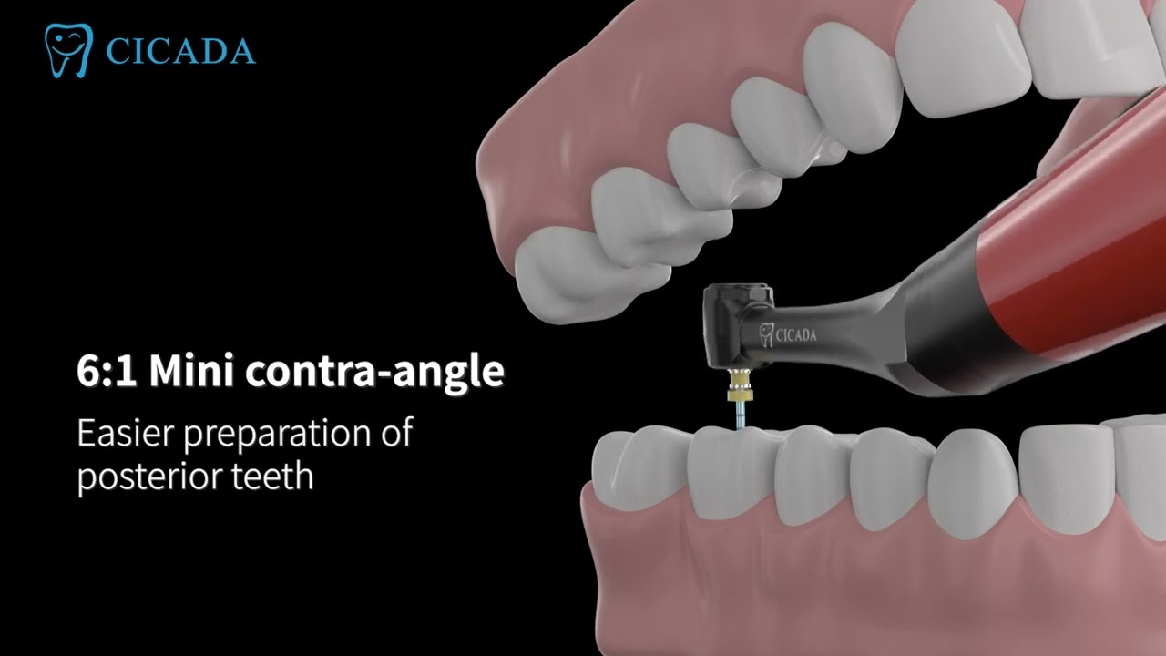 CICADA Brushless Endo Motor T-Fine-II (Plus)