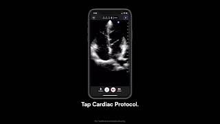 How to use Labeling Protocols: Butterfly Point-of-Care Ultrasound screenshot 5