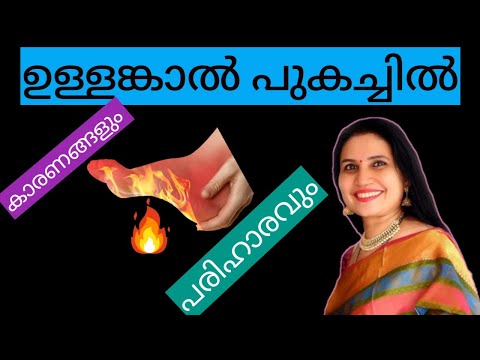 ഉള്ളങ്കാല്‍ പുകച്ചിൽ- Burning Soles