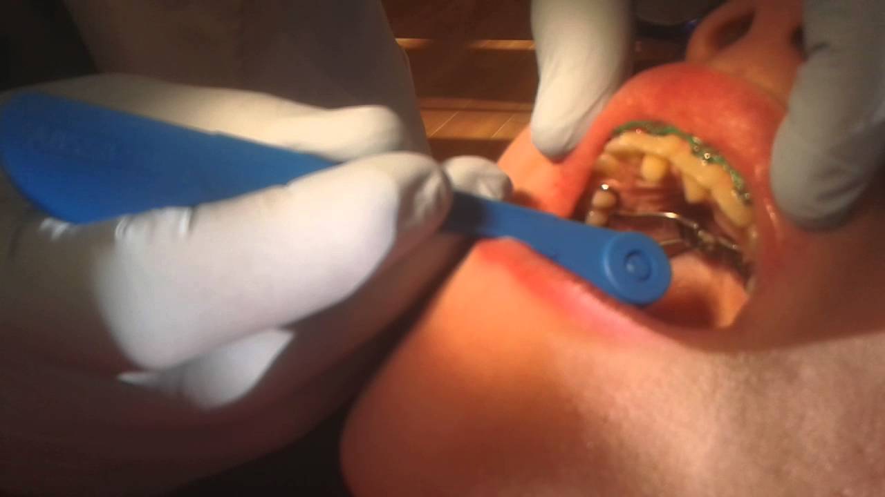 youtube-video-thumbnail