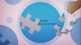 Accommodative esotropia