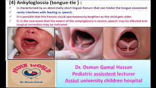 Pediatric Outpatient GIT Cases