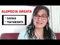 ALOPECIA AREATA  ---}  Causas y tratamiento {---