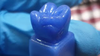 Carving upper first molar