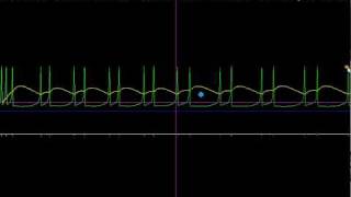 Spiker neuron