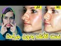 تصغير الأنف طبيعيا تنحيف بدون عملية تجميل 