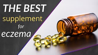 Eczema The Food Supplement I Wish I Started Taking Sooner ...
