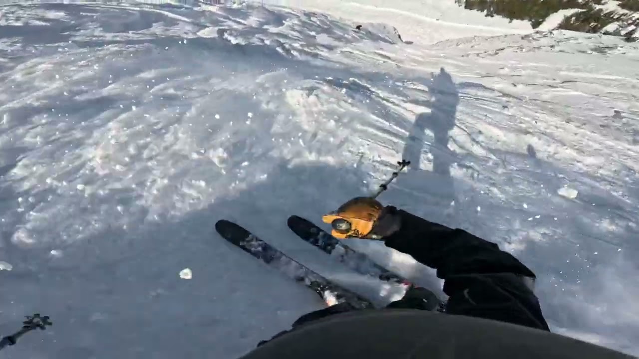 I suck at skiing