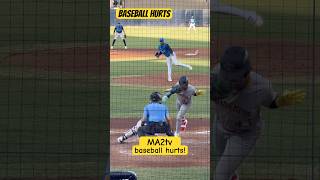 Baseball Hurts Hbp Part Of The Game, Take The Free 90