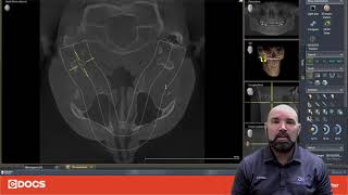 Tip Of The Day Axeos Scan