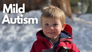 Diagnosis of Mild Autism in 2yearold