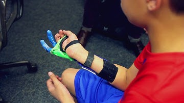 e-NABLE Arm Prosthetics - Ultimaker: 3D Printing Story