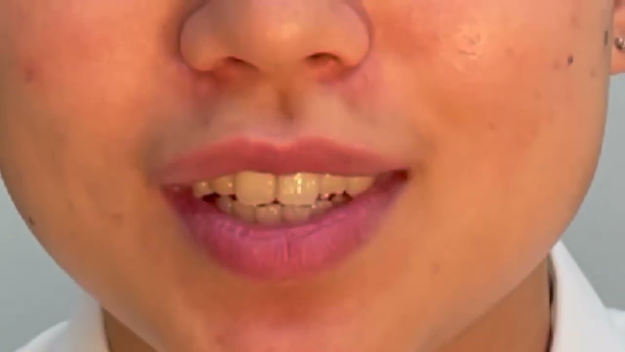 Korean / Busan accent - Korea 2 (F, 25, Busan, South Korea)