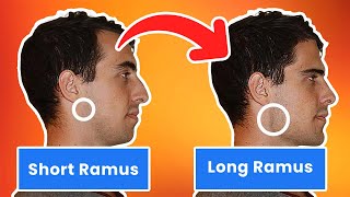 The High Importance of The Ramus For The Jaw - (blackpill anaylsis) Resimi