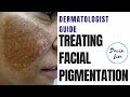 How to treat PIGMENTATION