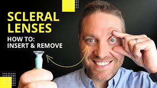 Scleral Lenses Insertion And Removal: Plus Pro Tips For Beginners!