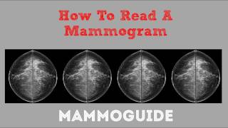 How To Read A Mammogram