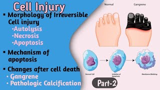 Cell injury || Morphology of Irreversible Cell injury explained in tamil || MT Easy Learning