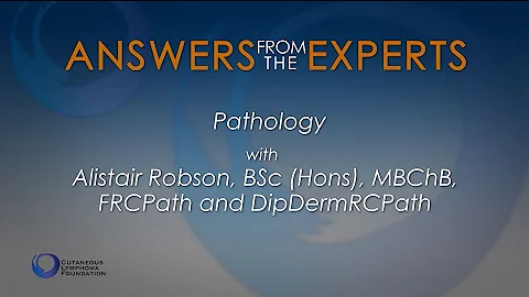 Answers from the Experts: Pathology of Cutaneous Lymphoma - DayDayNews
