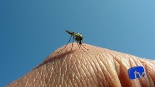 E calafrios dor dores de musculares e tenho febre cabeça e eu