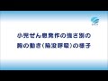 小児ぜん息発作の強さ別の胸の動き（陥没呼吸）の様子