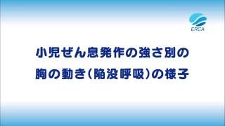 小児ぜん息発作の強さ別の胸の動き 陥没呼吸 の様子 Youtube