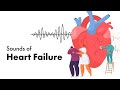 Sounds of heart failure  medzcool