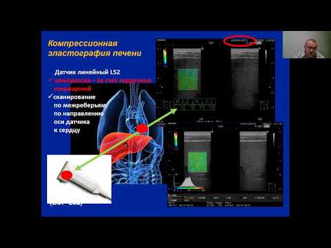 Ультразвуковая эластография селезенки