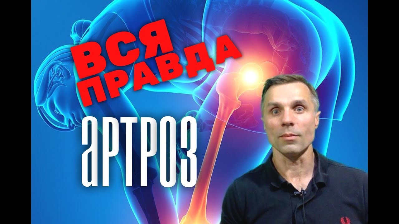 Лечим артроз в ютубе thumbnail