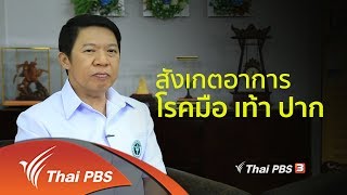 รู้สู้โรค : ป้องกันโรคมือ เท้า ปาก (5 มิ.ย. 61)