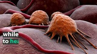 Scientists Make Strides In Cancer Research