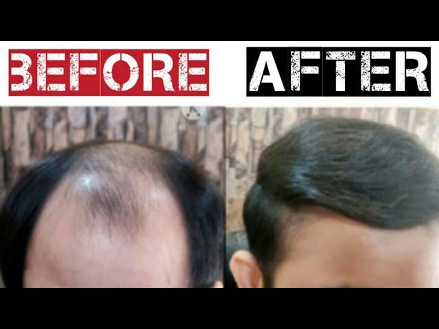 Does Hair Fiber SPRAY Work? BETTER Hair Coverage? - YouTube