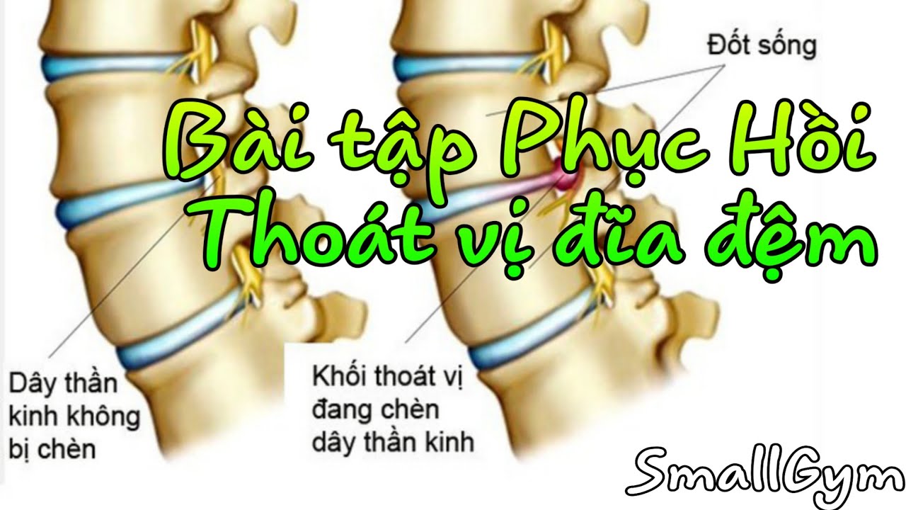 Ph c H i Tho t V a m Disc Herniation Rehab Exercises SmallGym ph-c-h-i-tho-t-v-a-m-disc-herniation-rehab-exercises-smallgym