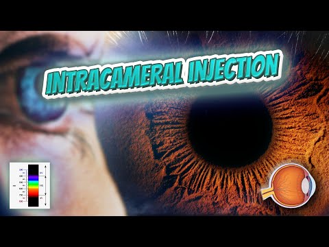 Intracameral injection (Your EYEBALLS) 👁️👁️💉😳💊🔊💯✅