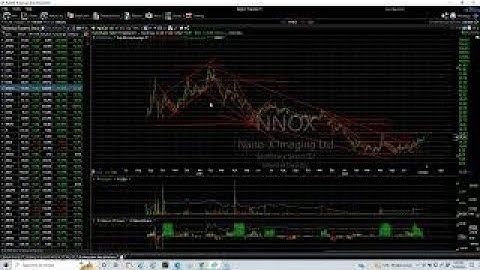 Charts of the Day, Harry Boxer, TheTechTrader.com