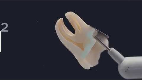 SDR flow+ 10 Year Annniversary | Dentsply Sirona