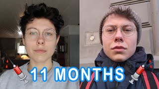 11 Months on T Update - FTM Trans Guy