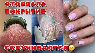 Скрученные ногти 😐 Оторванное покрытие 💅 Маникюр на квадрат