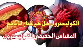 اسباب ارتفاع معدل الكوليسترول وعلاجه وماهى المعدلات المظبوطة_مع الدكتور