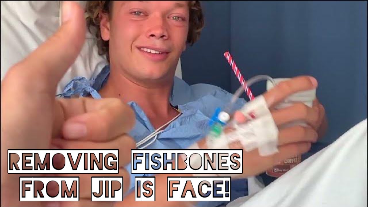 ⁣REMOVING FISH BONES from Jips face! Ep.50