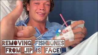 REMOVING FISH BONES from Jips face! Ep.50