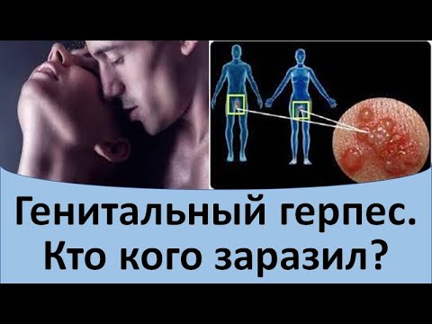 Генитальный герпес. Кто кого заразил.