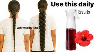 You Wont Recognise Your Hair In March . Your Hair Might Grow Too Fast