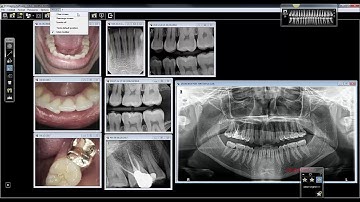 CS Imaging - Find, Open, Arrange and Present Images most efficiently