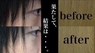 簡単 鼻を叩いて 鼻高くなる 検証 Youtube